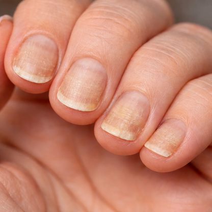 NailBella™ — Cosmetic Nail Care Serum